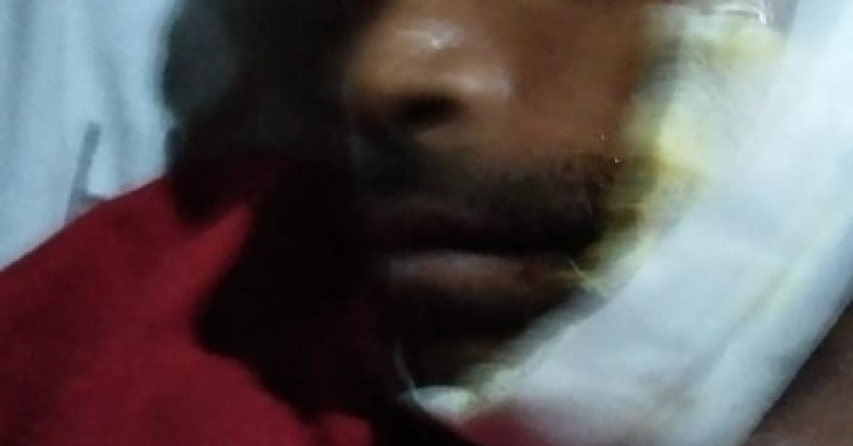 মন্ত্ৰী ডঃ হিমন্ত বিশ্ব শৰ্মাৰ কনভয়ে মহটিয়াই নিলে এজন চাহ শ্ৰমিকক