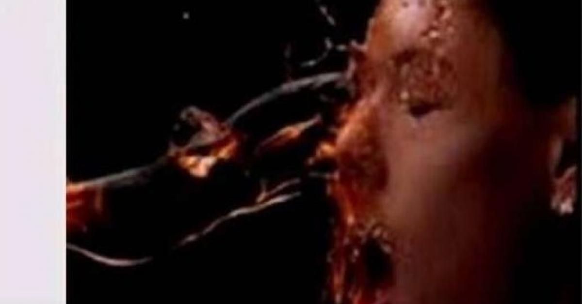 মৃত্যুৰে যুঁজিছে শিশু, কিশোৰীসহ তিনিজনে