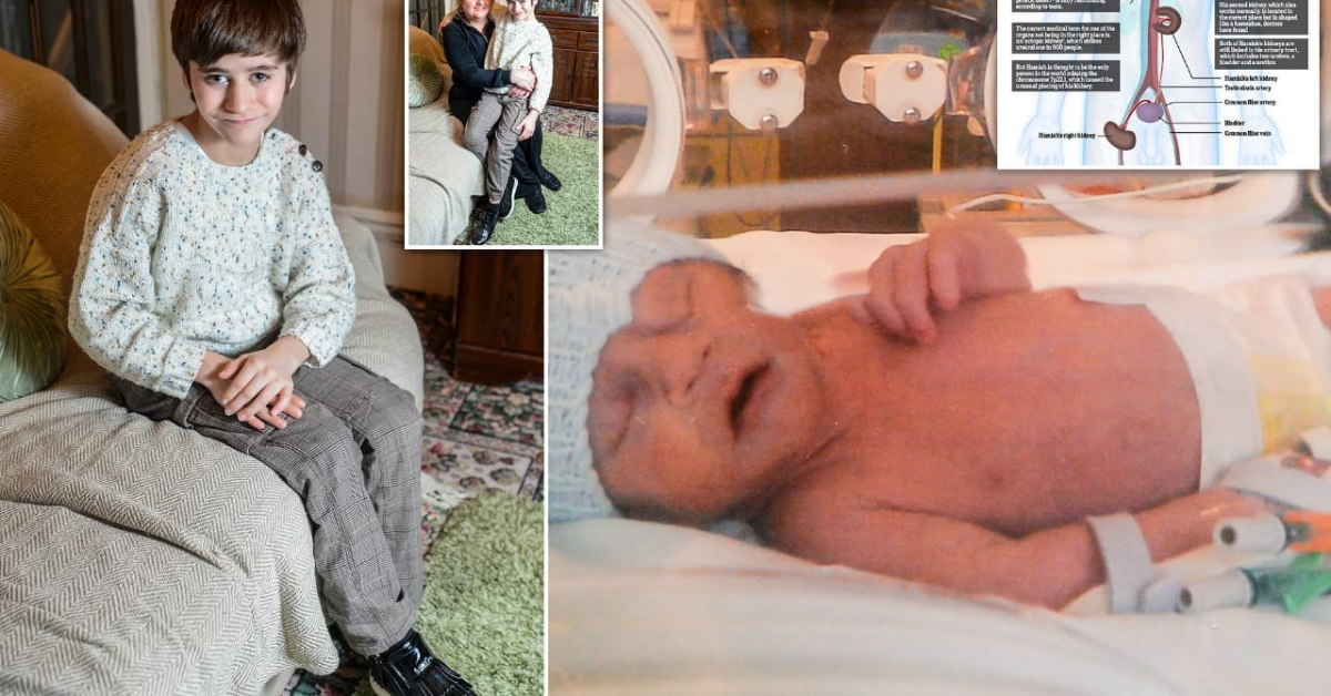 এটি শিশুৰ কিডনি আছে ভৰিত!