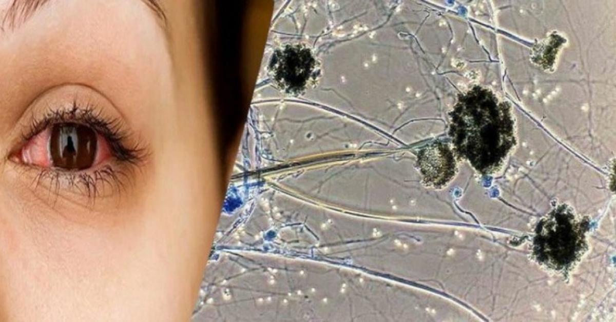 ব্লেক ফাংগাছৰ টাৰ্গেট শিশু-কিশোৰ 