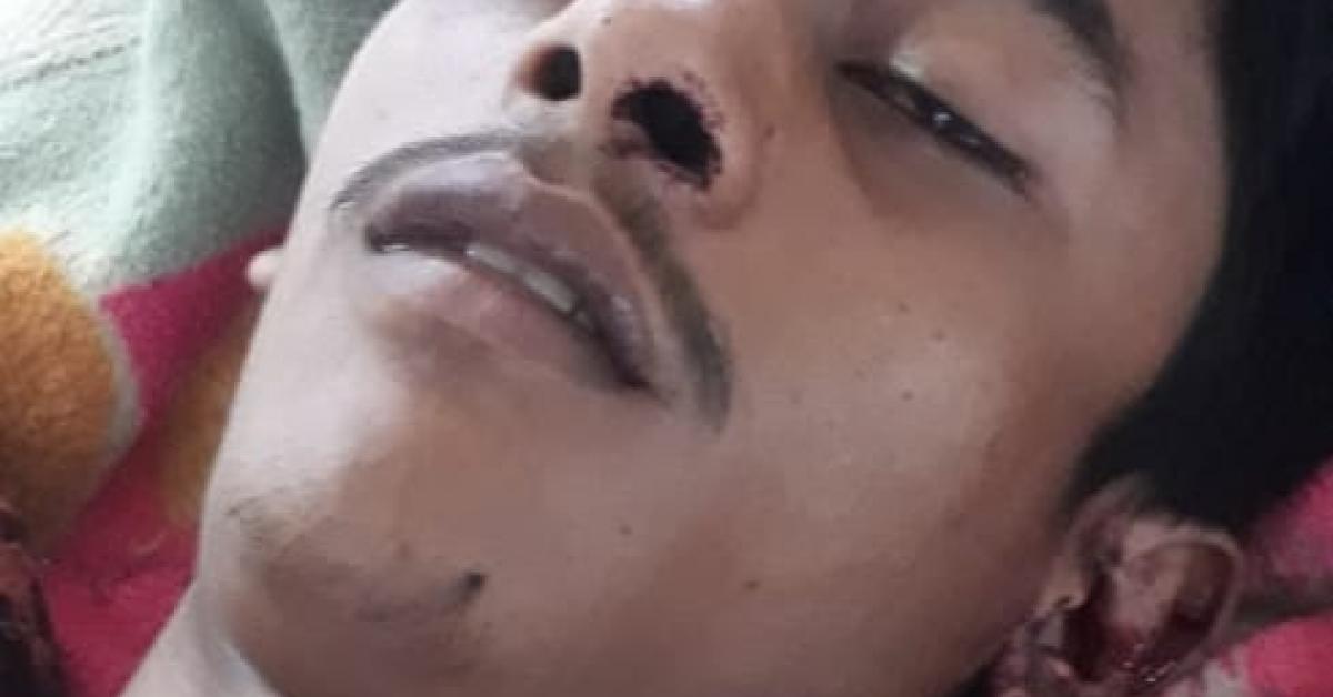 প্ৰেমিকাই ফোন কৰাৰ পাছতেই নলাৰ পৰা সংকট জনক অৱস্থাত উদ্ধাৰ প্ৰেমিক 