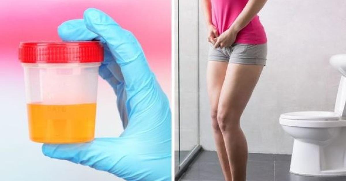 Urine Infection