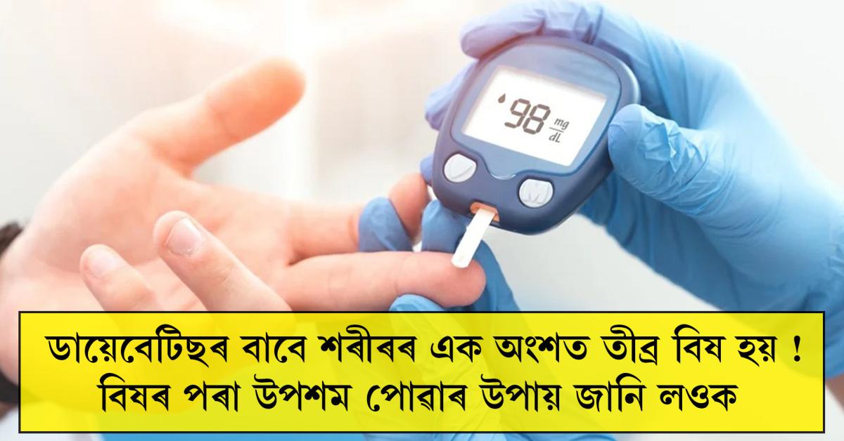 ডায়েবেটিছ এনেকুৱা এটা ৰোগ যিটো আন বহু সমস্যাৰ মূল বুলি গণ্য কৰা হয়