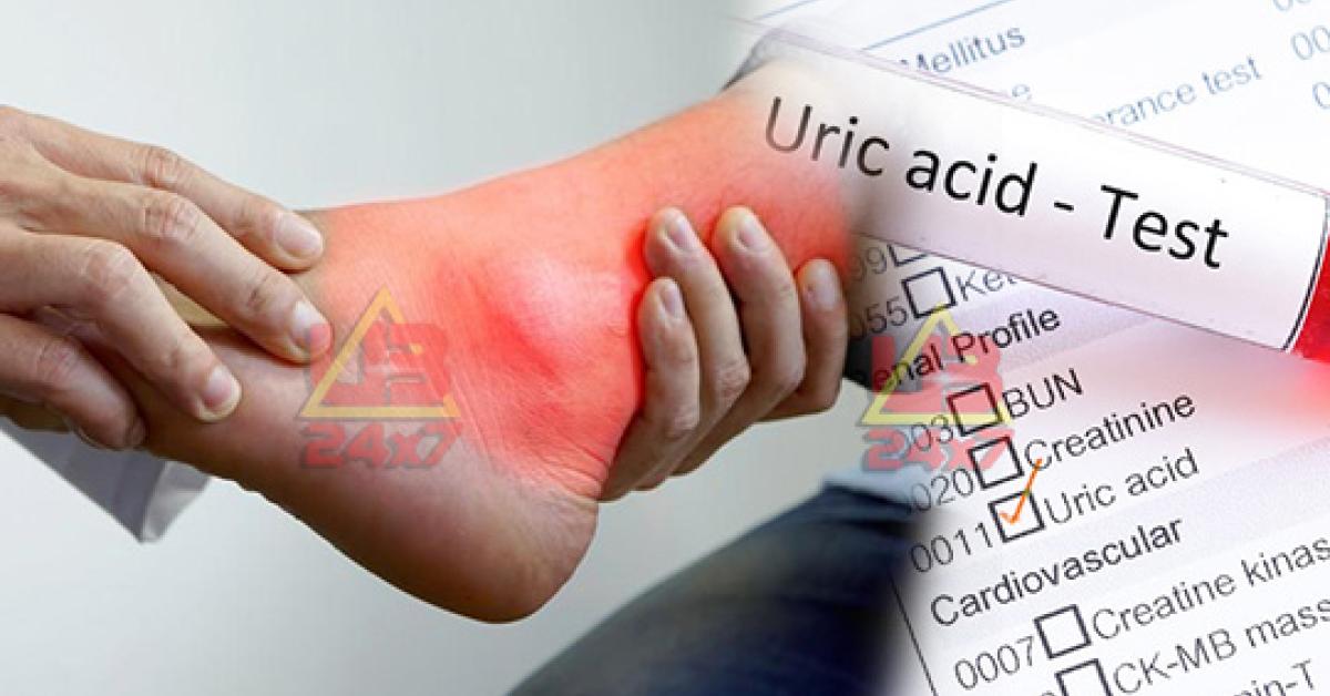 Uric Acid