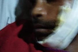 মন্ত্ৰী ডঃ হিমন্ত বিশ্ব শৰ্মাৰ কনভয়ে মহটিয়াই নিলে এজন চাহ শ্ৰমিকক