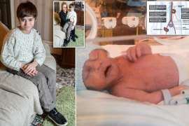 এটি শিশুৰ কিডনি আছে ভৰিত!