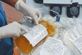 কৰ’ণা ৰোগীক এতিয়াৰে পৰা দিয়া নহ’ব প্লাজমা