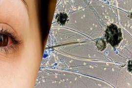 ব্লেক ফাংগাছৰ টাৰ্গেট শিশু-কিশোৰ 