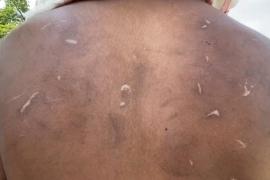 A female teacher from Dibrugarh tortures her adopted 13 years old son