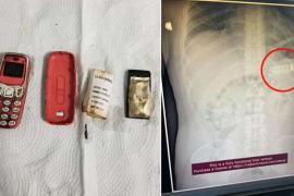 A 33-year-old man comes into the limelight after swallowing a mobile phone